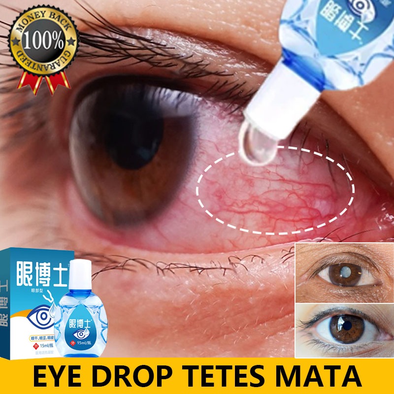 Obat mata katarak Tetes mata Obat mata Yehuangsu tetes mata Vitamin mata kesehatan mata Alat tetes m