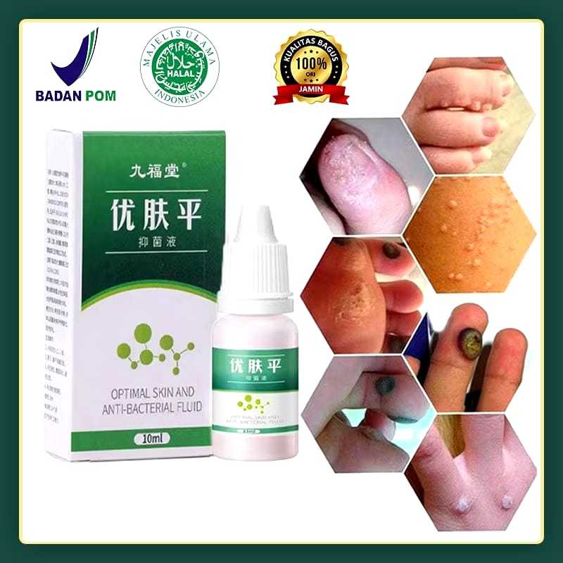 CARA CEPAT HILANGKAN SEMUA JENIS KUTIL/KUTIL KELAMIN PRODUK ASLI 100% ORIGINAL Obat Semu Jenis Kutil