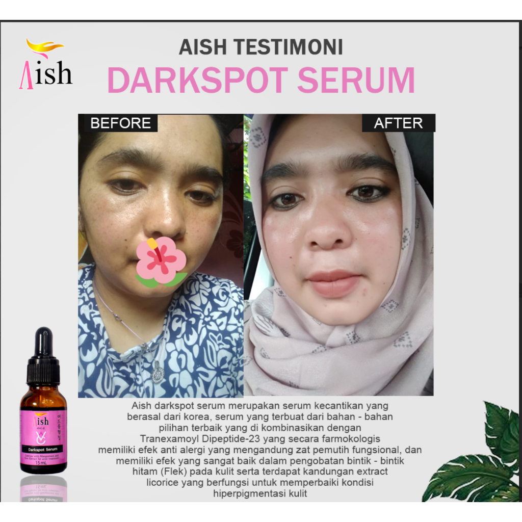 Promo 2 pcs Aish serum Darksport -menghilangkan Flek Hitam Original Bpom | Serum Aish Darkspot | Ori