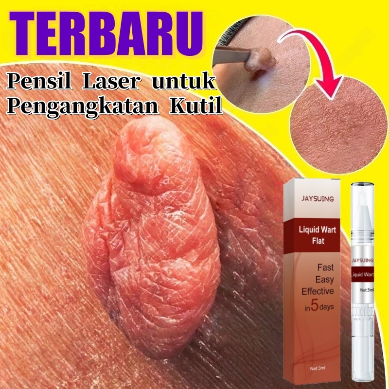 Pena Cair Penghilang Kutil Dan Tahi Perawatan Penghilang Tahi Lalat Kutil Di Wajah Skin Tag Remover 