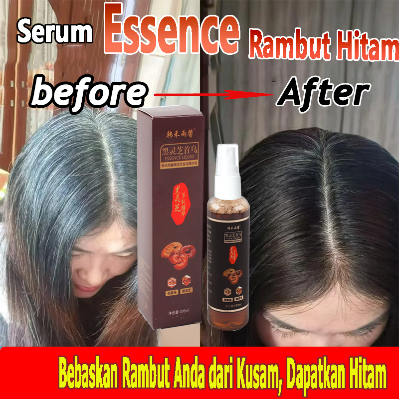 Penghitam Rambut Permanen Serum penghitam rambut uban permanen Serum Penumbuh Rambut Cepat 100ML Ram