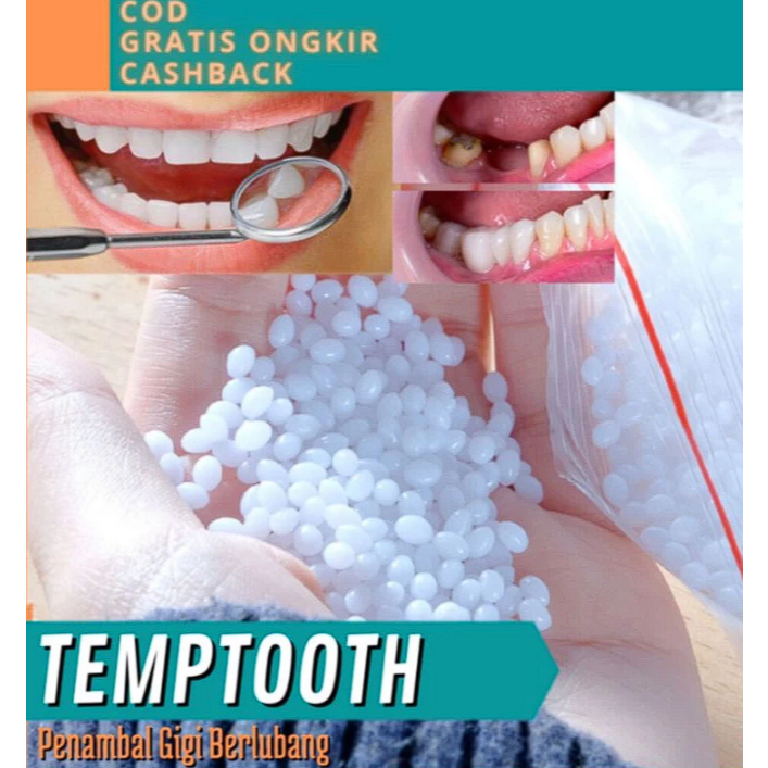 TEMPTOOTH Penambal Gigi Berlubang / Penambal Gigi Berlubang