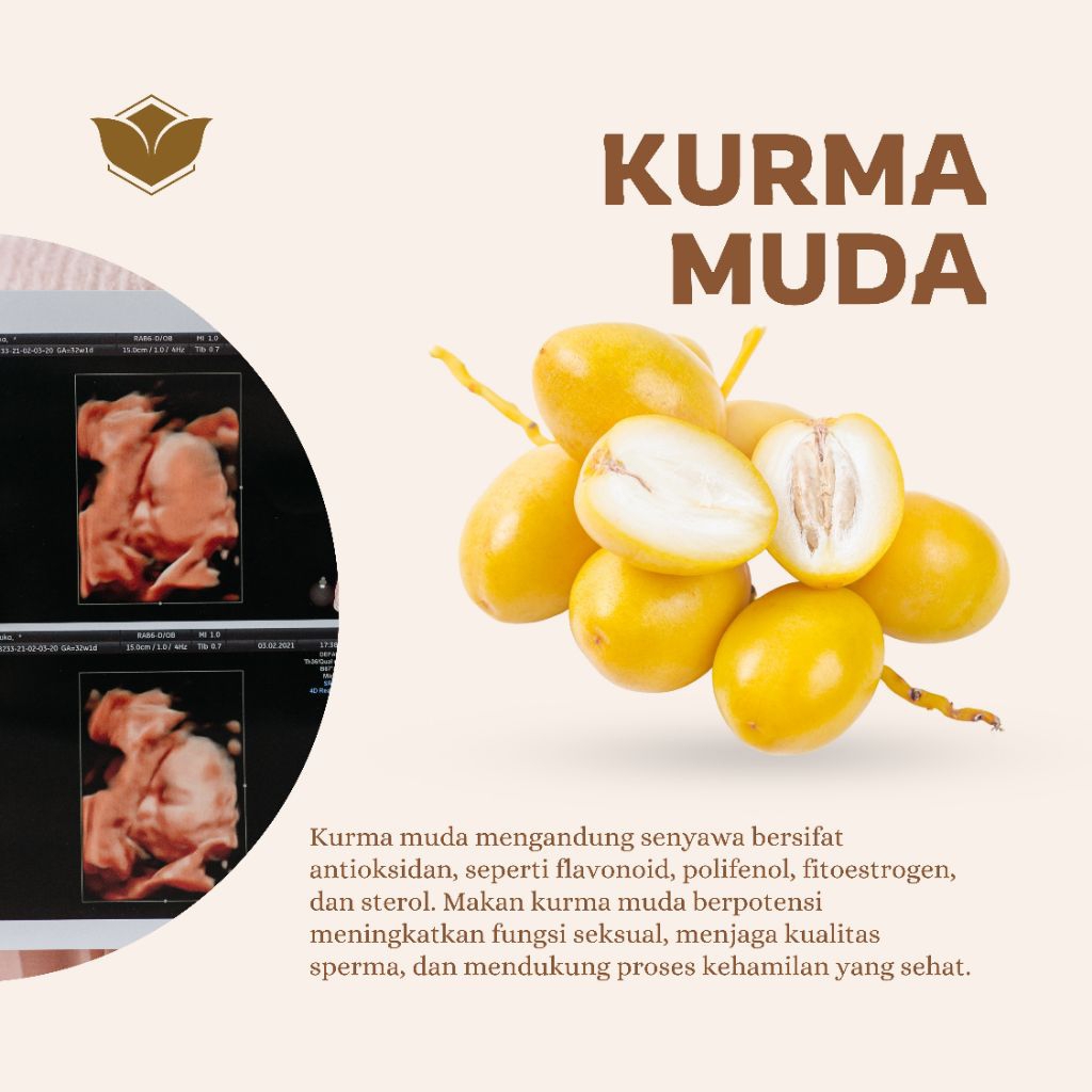 

READY TANPA PO! Kurma Muda Segar Membantu Program Hamil Promil