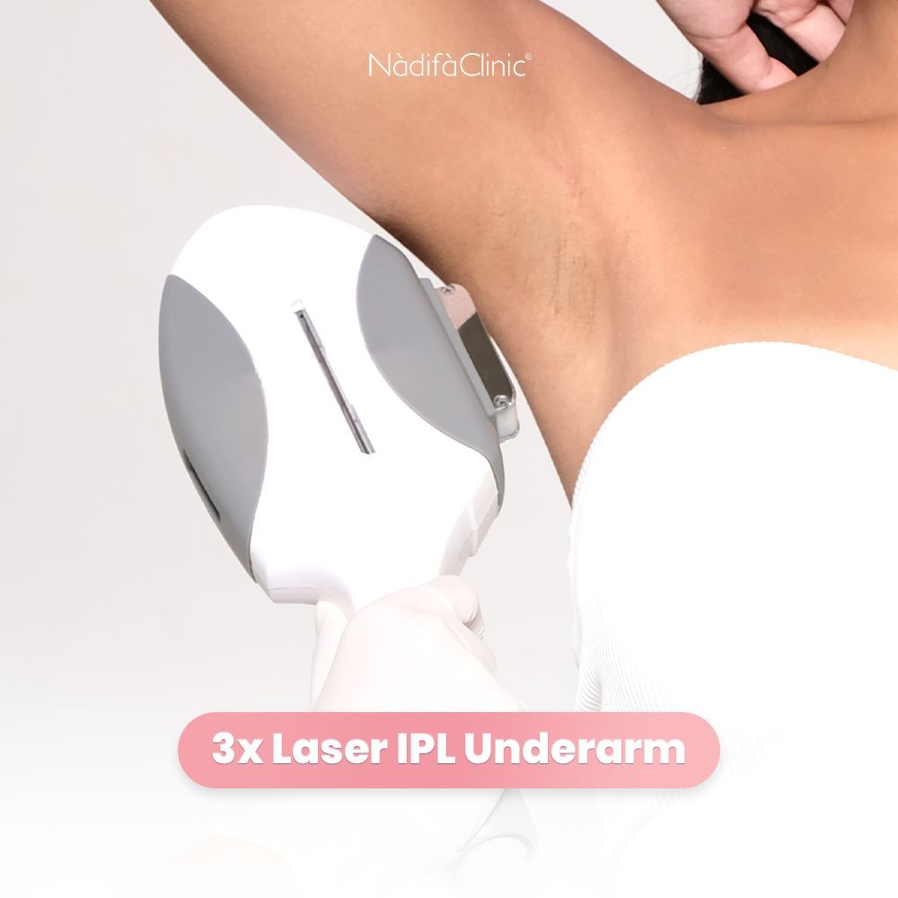 3x Treatment Leaser IPL Underarm