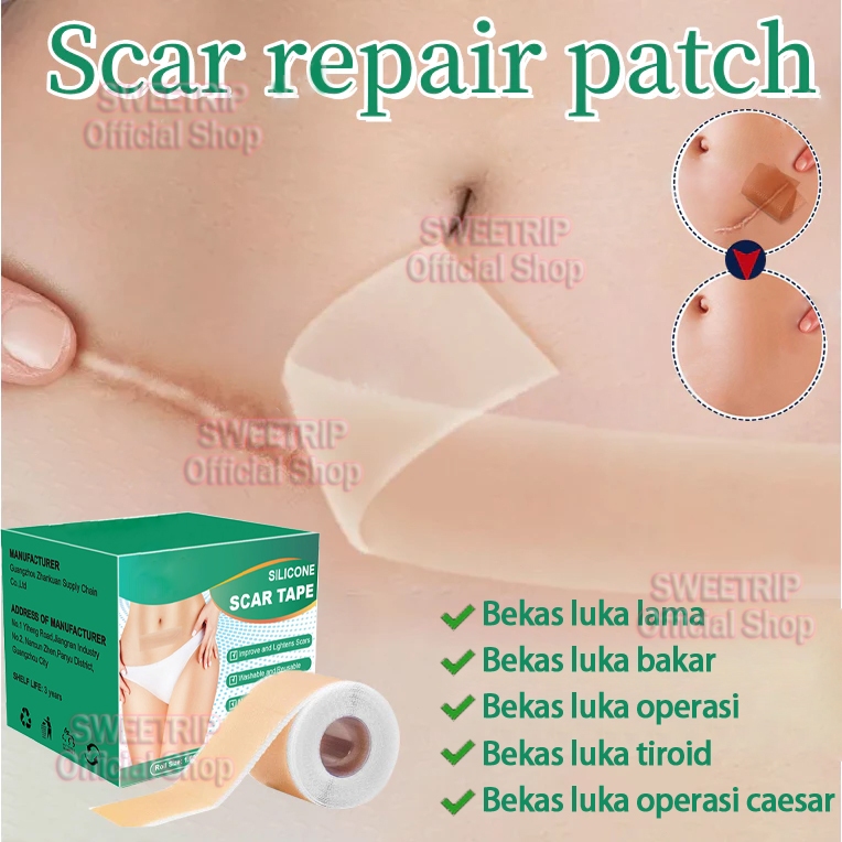 Silicone Scar Sheets Plaster Penghilang Bekas Luka Keloid plester bekas luka 4cm x 1.5m plester Scar