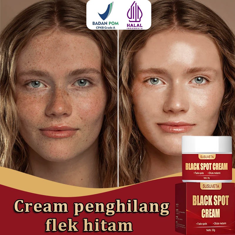 (BPOM)Krim pemutih wajah cream flek hitam membandel cream penghilang flek hitam 30ml Remove Dark Spo
