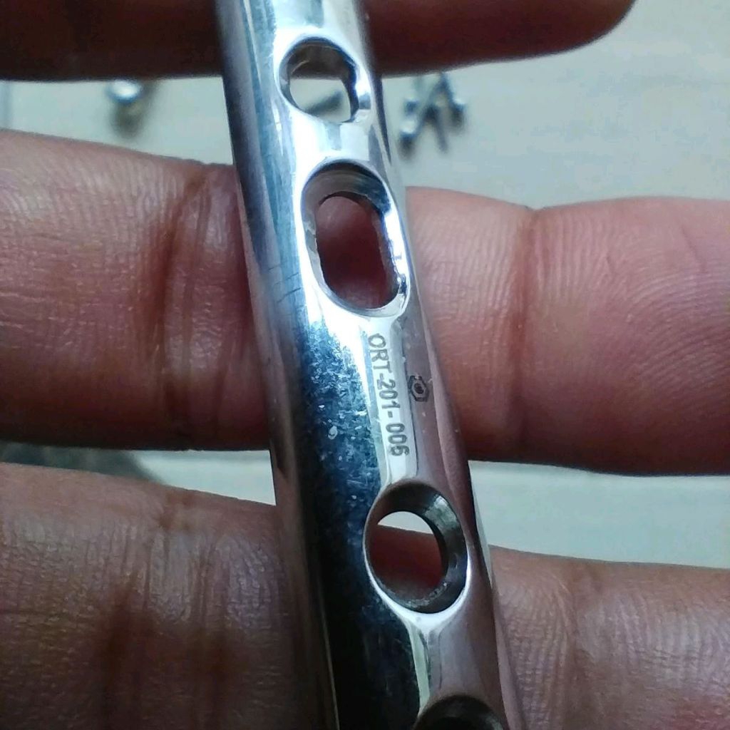 platina patah tulang pen