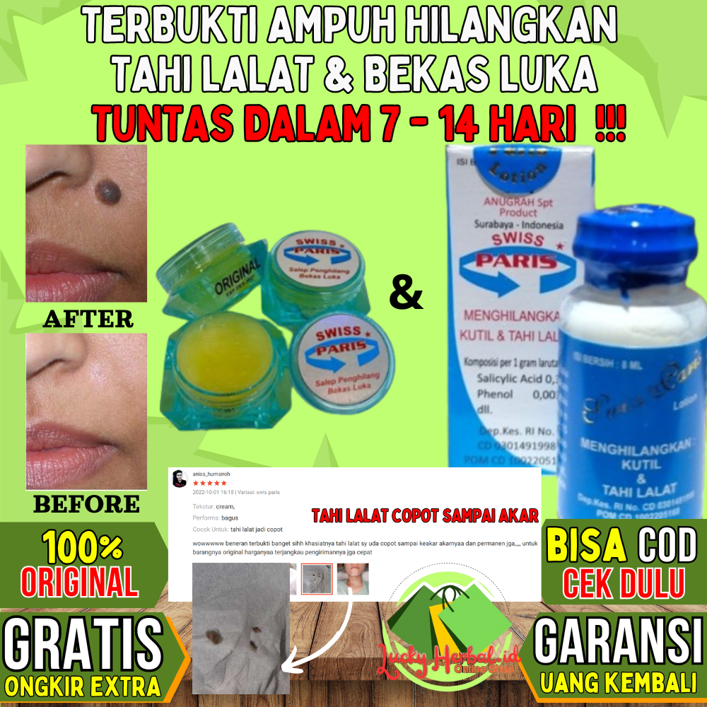 Swiss Swis Paris Lotion 100% Asli Ori Original Obat Cream Krim Salep Penghilang Menghilangkan Pencab