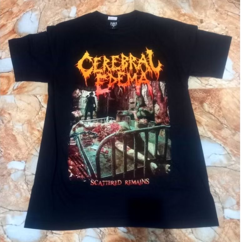Ts CEREBRAL EDEMA scattered