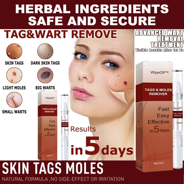 Obat Kutil Paling Ampuh Penghilang Kutil Obat Kutil Kelamin Obat Kutil Di Leher Wipeoff Penghilang K