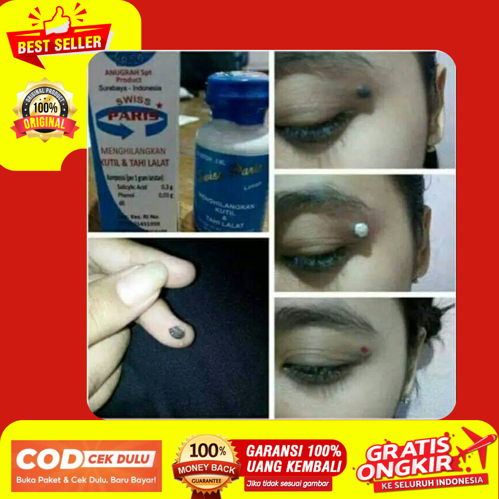 RB6 Swis Paris Lotion 100% Obat Cream Krim Salep Penghilang Menghilangkan Tahi Tai Lalat Kutil