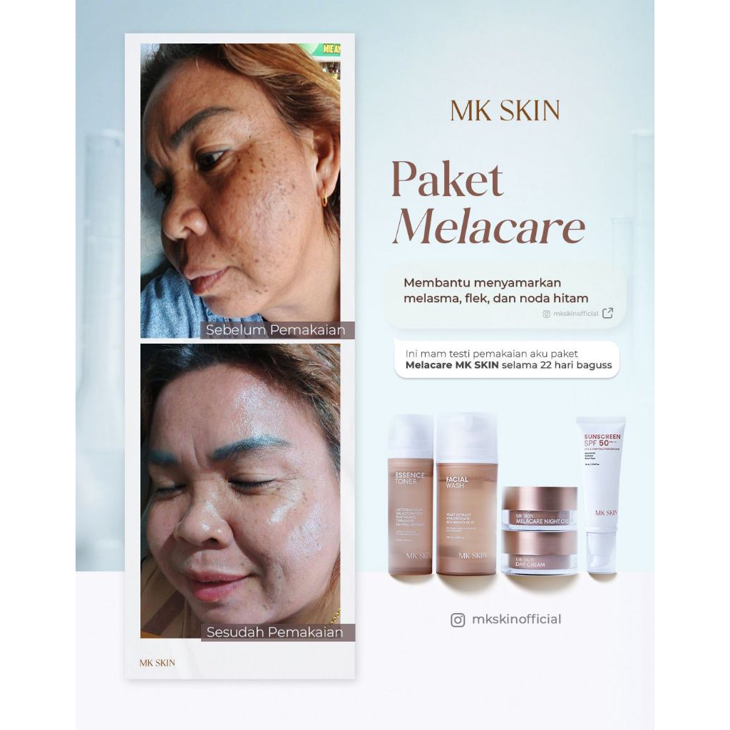 MK skincare