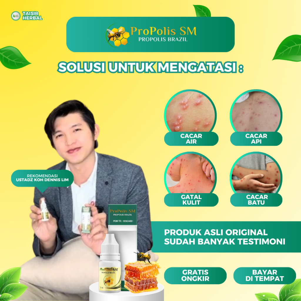 Propolis SM Atasi Cacar Air, Penghilang Cacar Air, Gatal Seluruh Tubuh, Gatal Berair Menyebar, Cacar