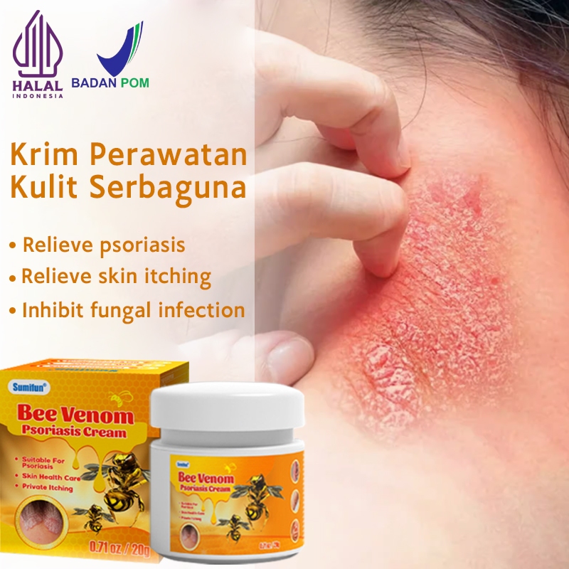 [Krim Kulit BPOM]Krim Perawatan Kulit Serbaguna - Atasi Kering, Iritasi & Ruam dengan Cepat,Formula 