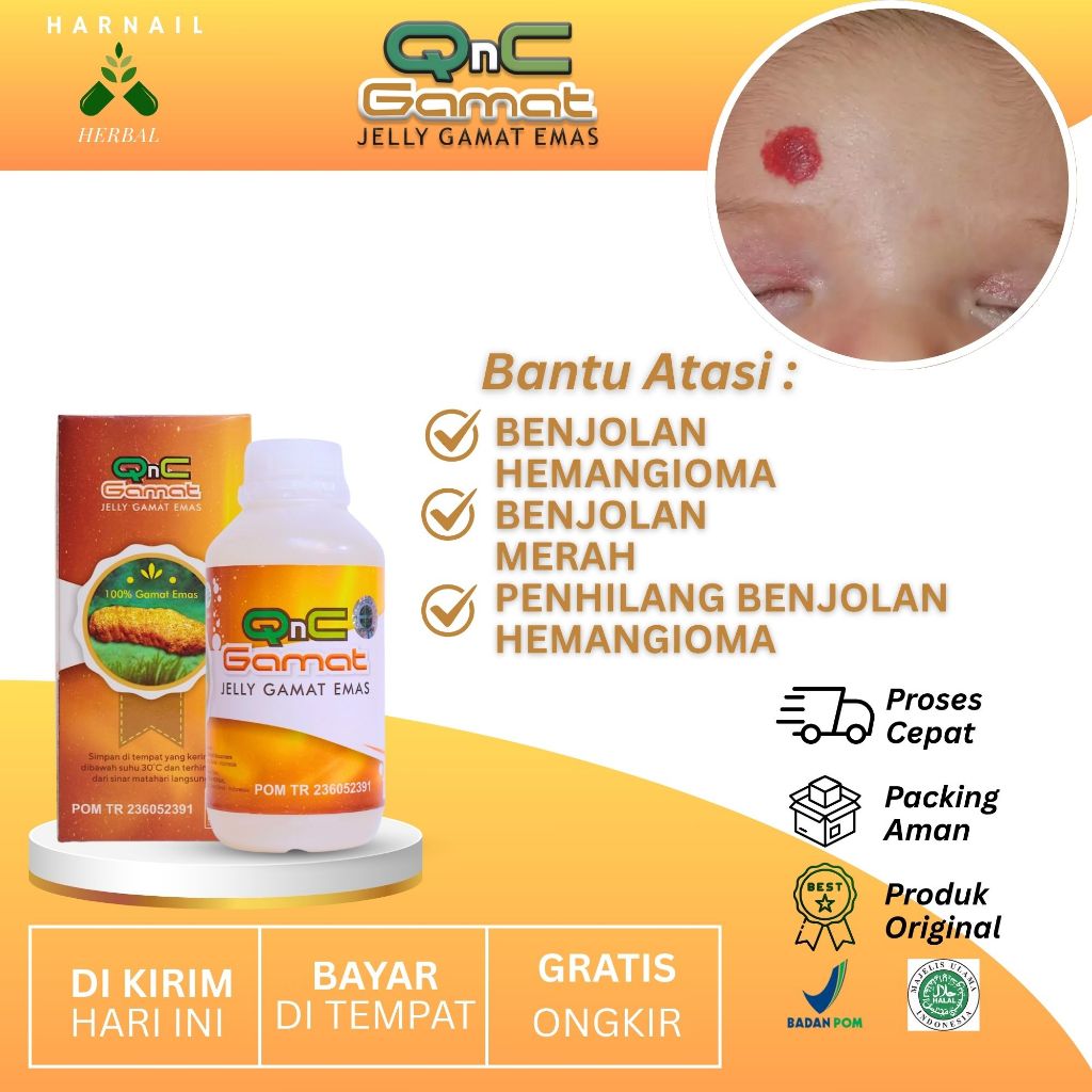Qnc Jelly Gamat Emas Obat Benjolan Hemangioma Benjolan MerahPenhilang Benjolan Hemangioma EKstrak Te