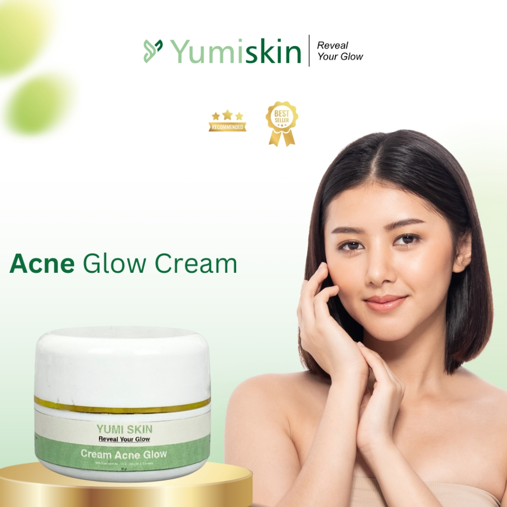 ACNE GLOW - label hijau CREAM MALAM JERAWAT 10gr