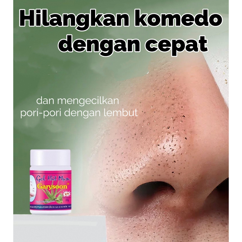 Menghilangkan komedo dan jerawat di hidung dengan cepat Masker dan gel penghilang komedo di hidung