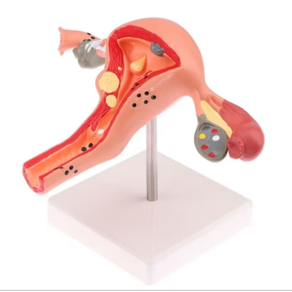 

UTERUS/ALATPERAGA/PENDIDIKAN