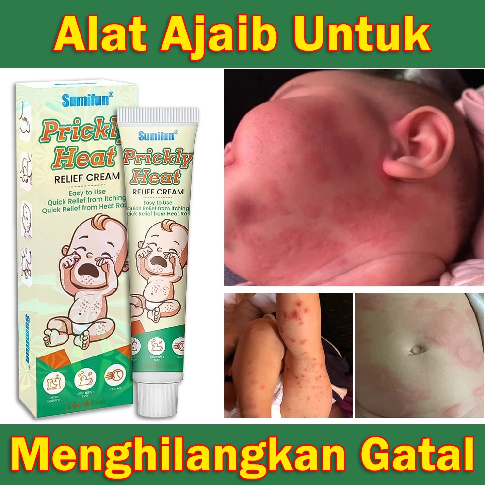 Krim Gatal Biang Keringat Herbal untuk Bayi Balita Anak-Anak / Krim Gatal untuk Bayi 20g
