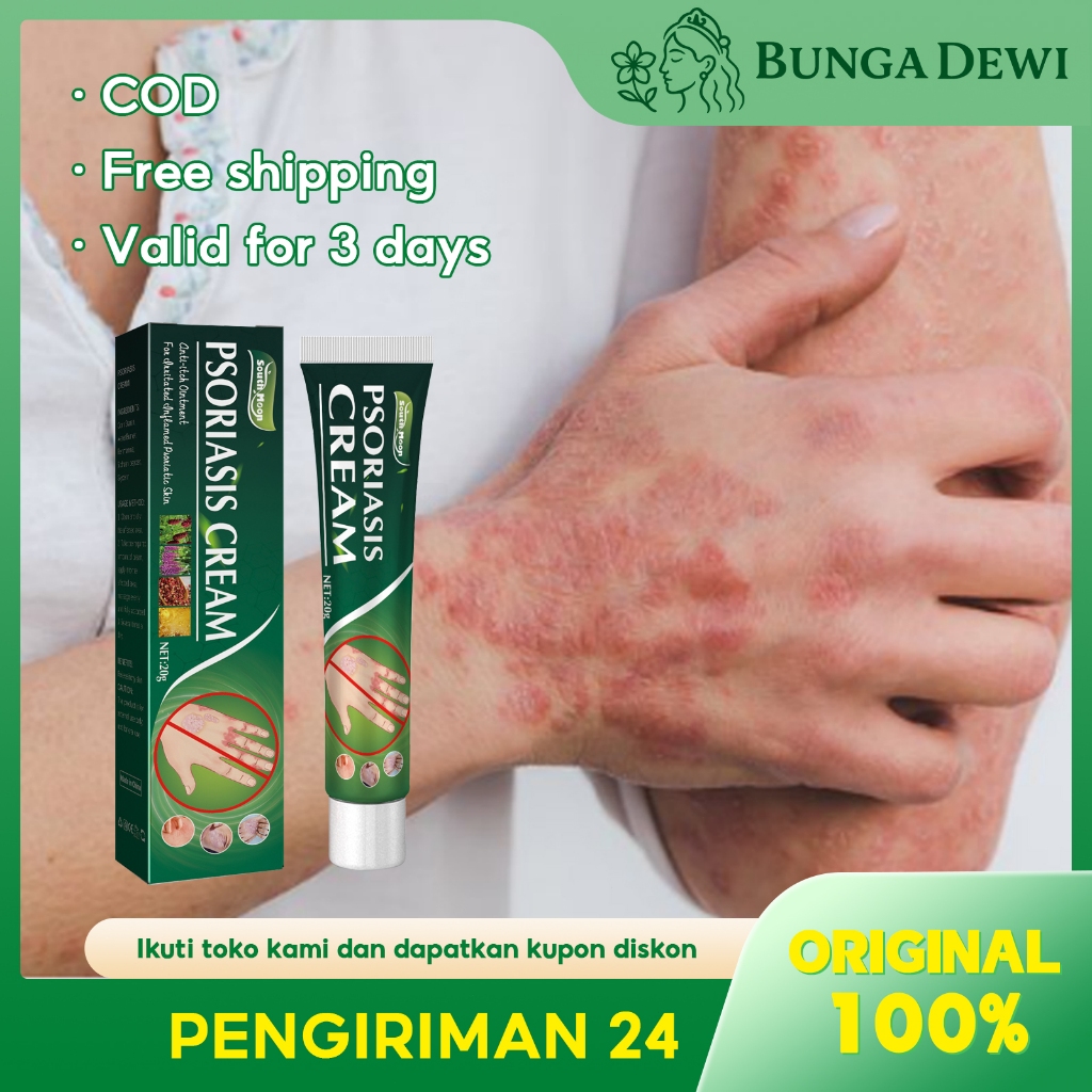 South Moon Psoriasis Cream 20g Salep Eksim Salep Psoriasis Krim Anti Eksim Cepat Redakan Gatal Gatal