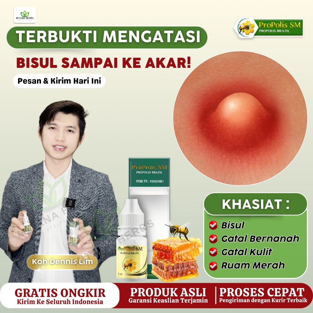 Obat Bisul, Bisul Di Pantat Bayi Anak Dan Dewasa Bisulan Bisul Bernanah Di Kelamin  Herbal Propolis 