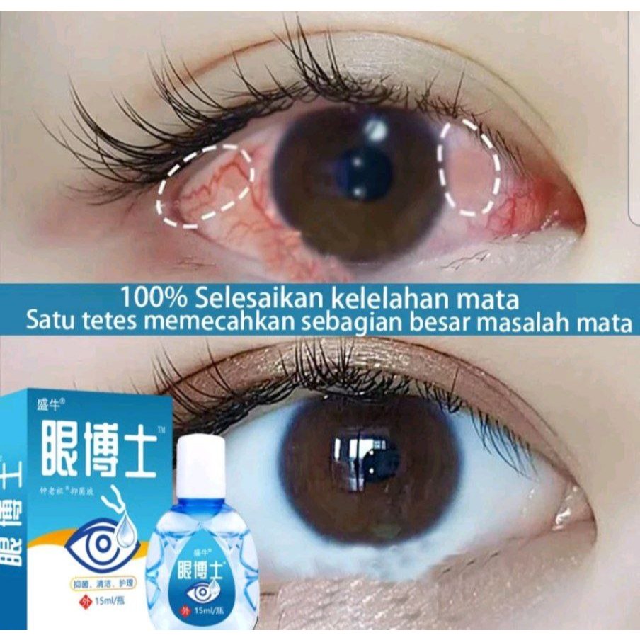 YEHUANGSU OBAT TETES MATA NO 1 JEPANG / TETES MATA JEPANG OBAT TETES MATA BERLEMAK KEKUNINGAN PTERIG