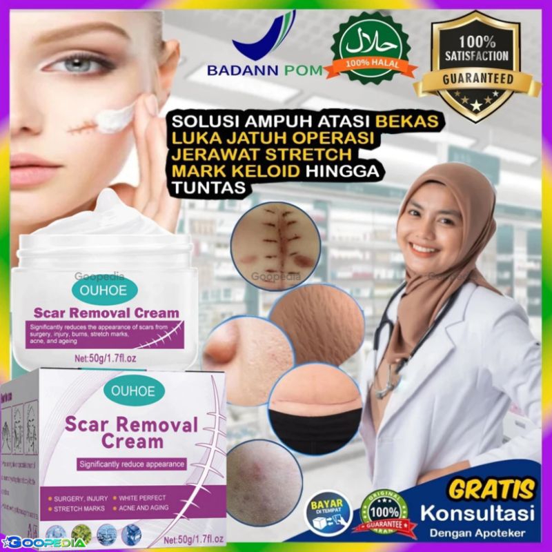 SALEP PENGHILANG BEKAS LUKA | SALEP KELOID & BEKAS LUKA BAKAR CACAR | KRIM SALEP BEKAS LUKA ASLI