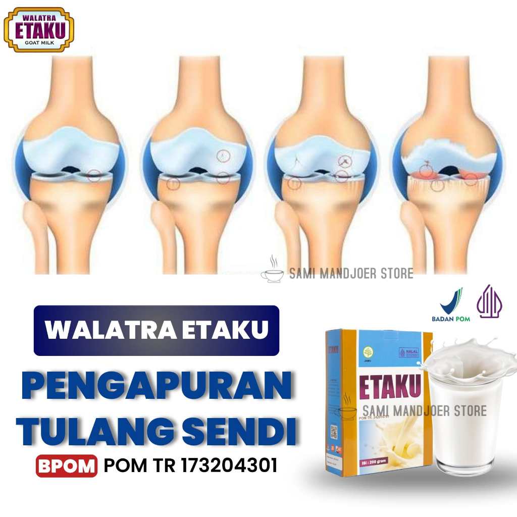 

Obat Pengapuran Nyeri Sendi Radang Sendi Pegal Linu Lutut Kaku Susu Kambing Etawa Walatra Etaku 250 gr