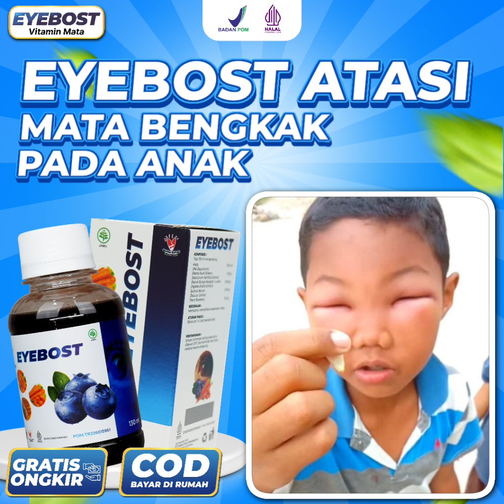 

Madu Eyebost Original Asli Mata Gatal Merah Bengkak Bintitan Jernih Cerah Minus Hilang Untuk Anak