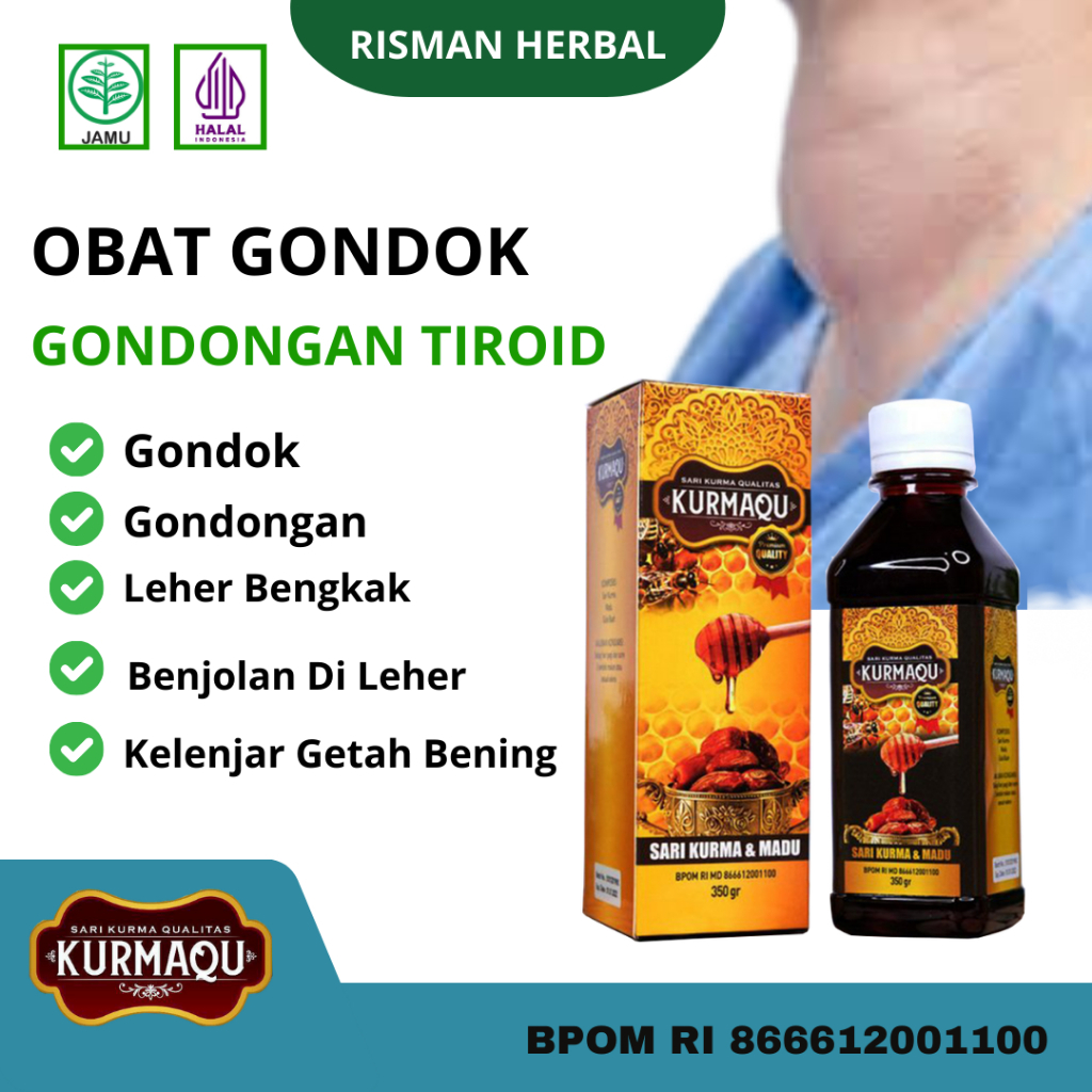 Madu Obat Gondok Gondongan Tiroid Sakit Saat Menelan, Benjolan  Bengkak di Leher Herbal KurmaQu