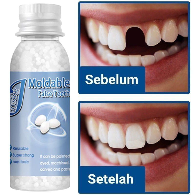 PENAMBAL GIGI BERLUBANG PATAH TERCABUT ORIGINAL