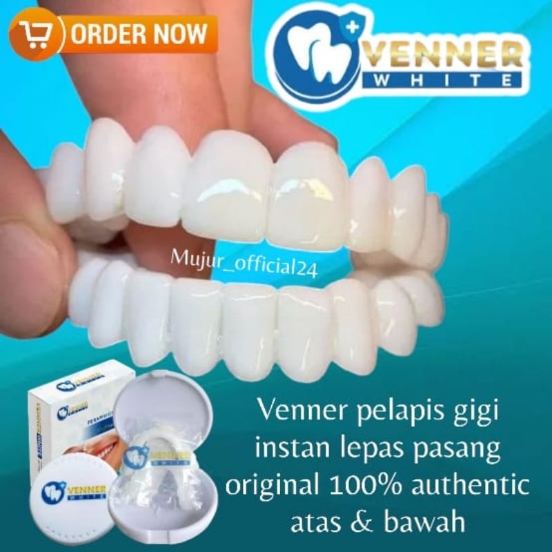 VENNER WHITE gigi palsu instan || perapih gigi 100% ORI