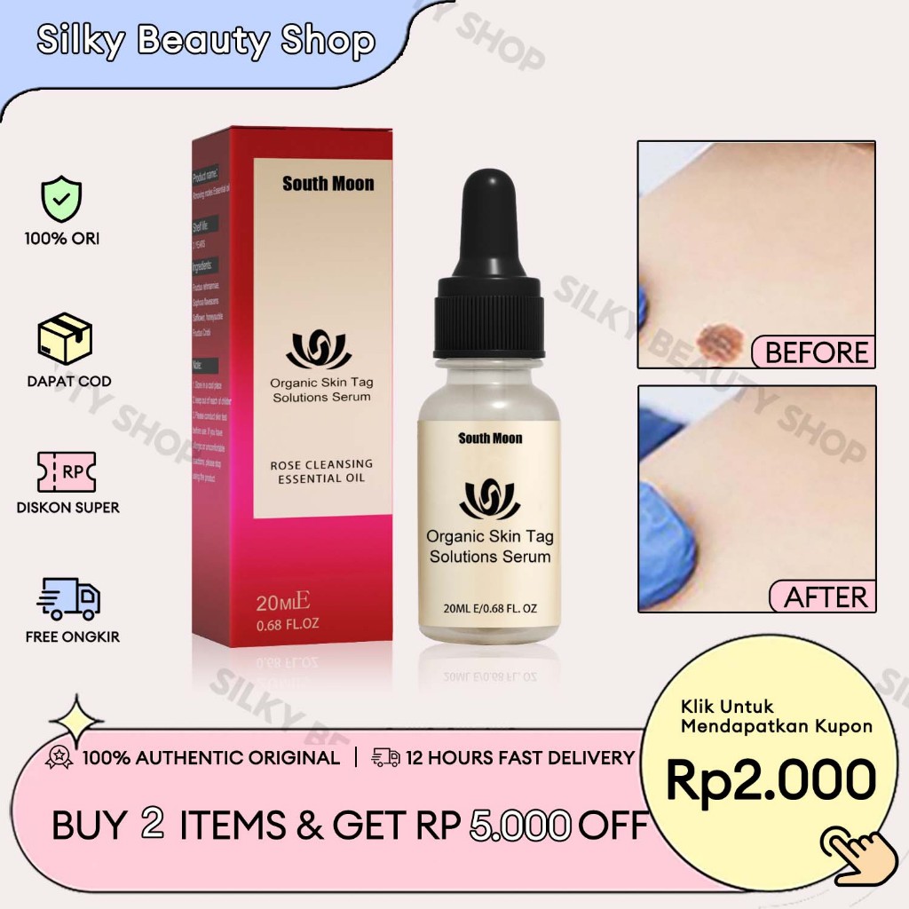 EELHOE【COD/ORI】Wart Removal Serum 20ml Penghilang Tahi Lalat Rose Serum Skin Tag Remover Penghilang 