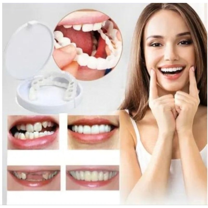 KUALITAS TERBAIK  Snap On Smile 100% ORIGINAL Gigi Palsu Snapon Smile 1 Set