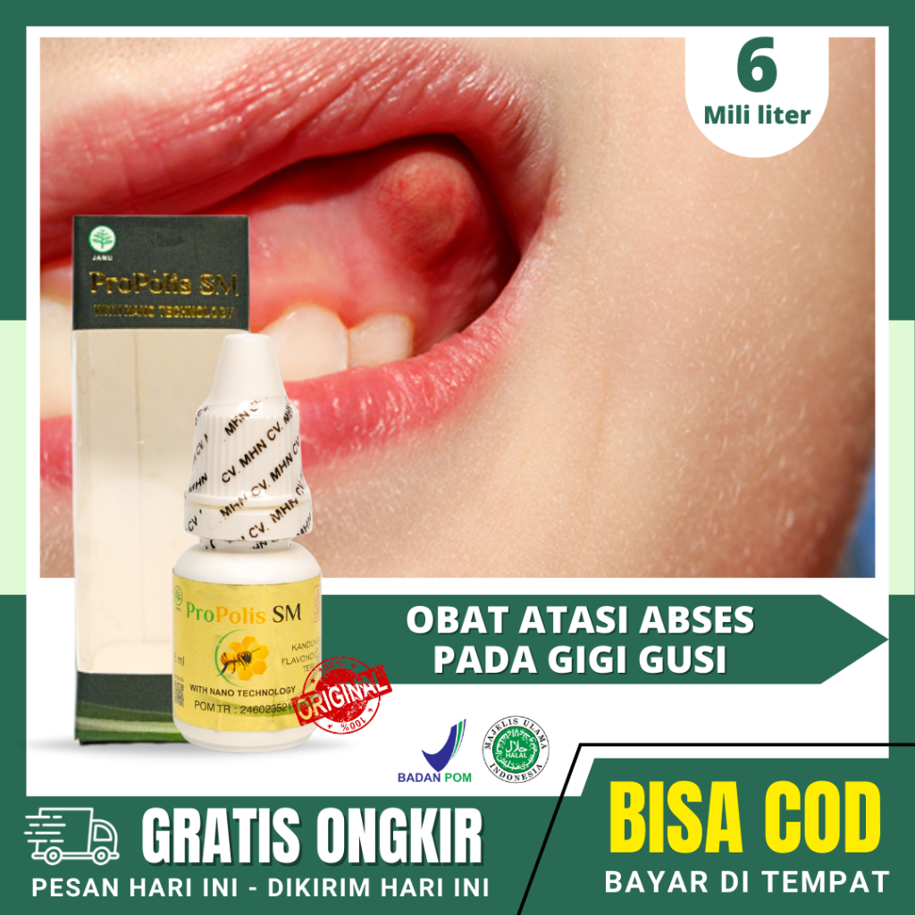 Obat Abses Gigi Gusi, Gusi Bernanah, Gusi Bengkak, Gigi Berlubang, Infeksi Gusi | PROPOLIS BRAZIL