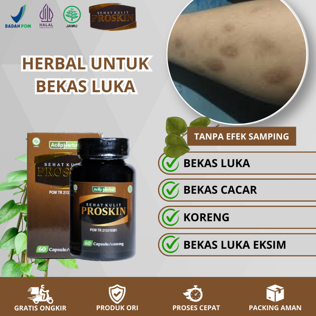 Obat Menghilangkan Bekas Luka, Koreng Di Kaki, Bekas Luka Eksim, Kadas Kurap Kudis Dengan ProSkin