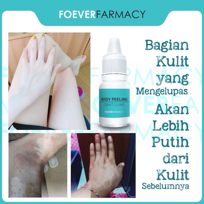 dr Titik Wahyuningsih PEELING PENGELUPASAN AMPUH  LOTION PEMUTIH  PEMUTIH BADAN  BODY PEELING  PEELI