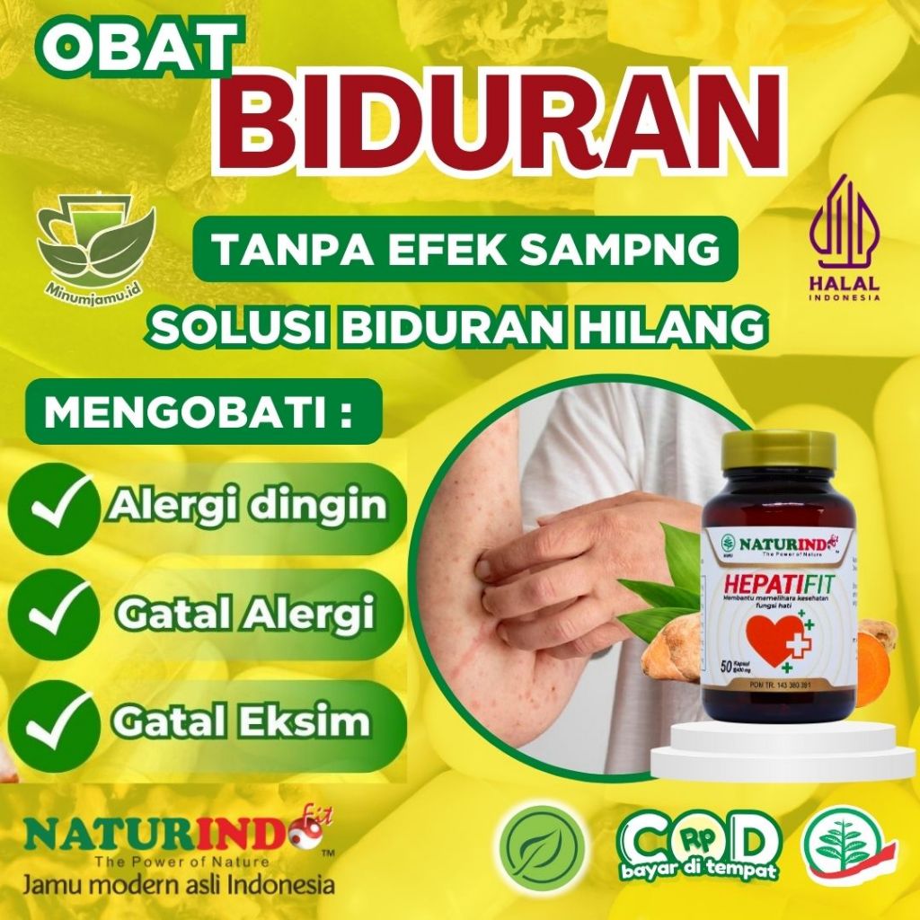 Obat Herbal Biduran Ampuh