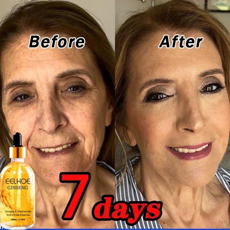 Serum Ginseng Anti Kerut Penghilang Kerutan Wajah Serum Anti Aging Dan Mencerahkan Serum mencerahkan