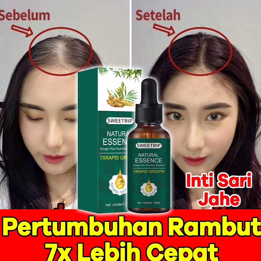 Booming Natural Beard Oil Serum Penumbuh Dan Penebal Cepat Rambut Brewok Kumis Jambang 7 Days Serum 