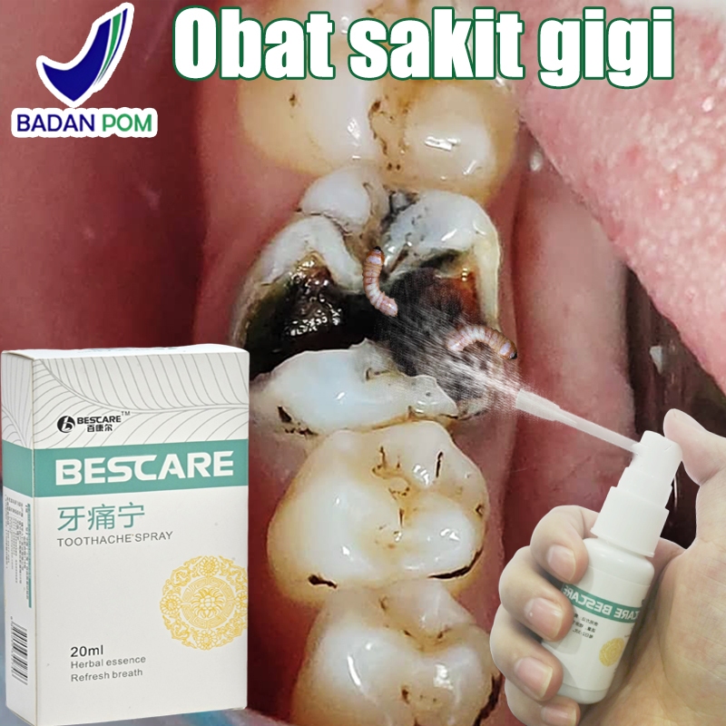 Obat sakit gigi berlubang Obat sakit gigi ampuh Obat sakit gigi anak 20ml Obat sakit gigi semprot Ob