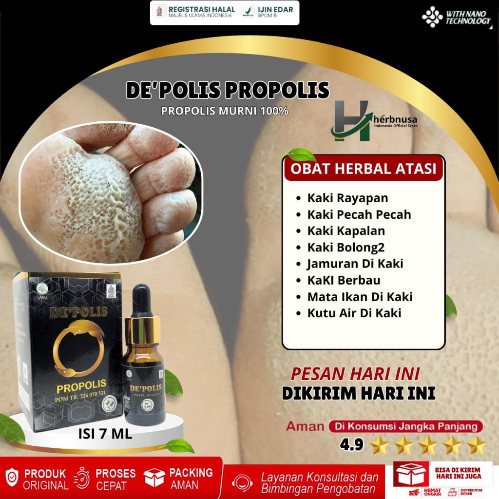 Obat Kaki Rayapan Dan Bau Pecah2 Kering Parah Salep De'Polis Propolis Brazil