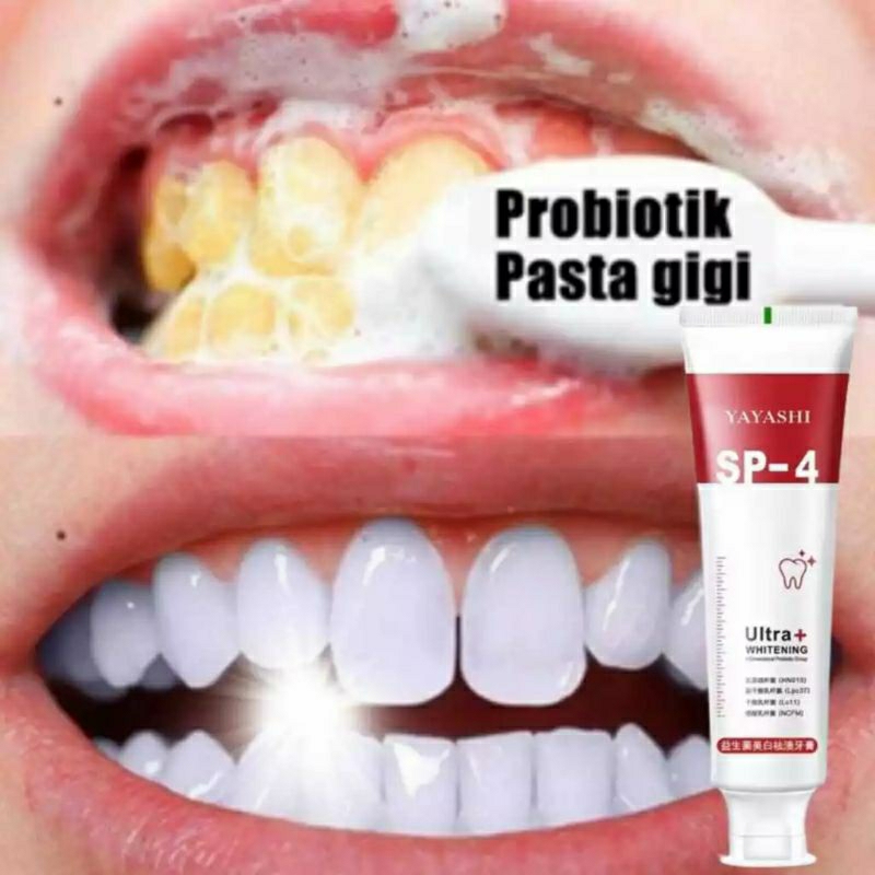 Whitening toothpaste Pasta Gigi Probiotik SP-4 Gigi putih Pasta gigi whitening Pasta gigi pemutih gi