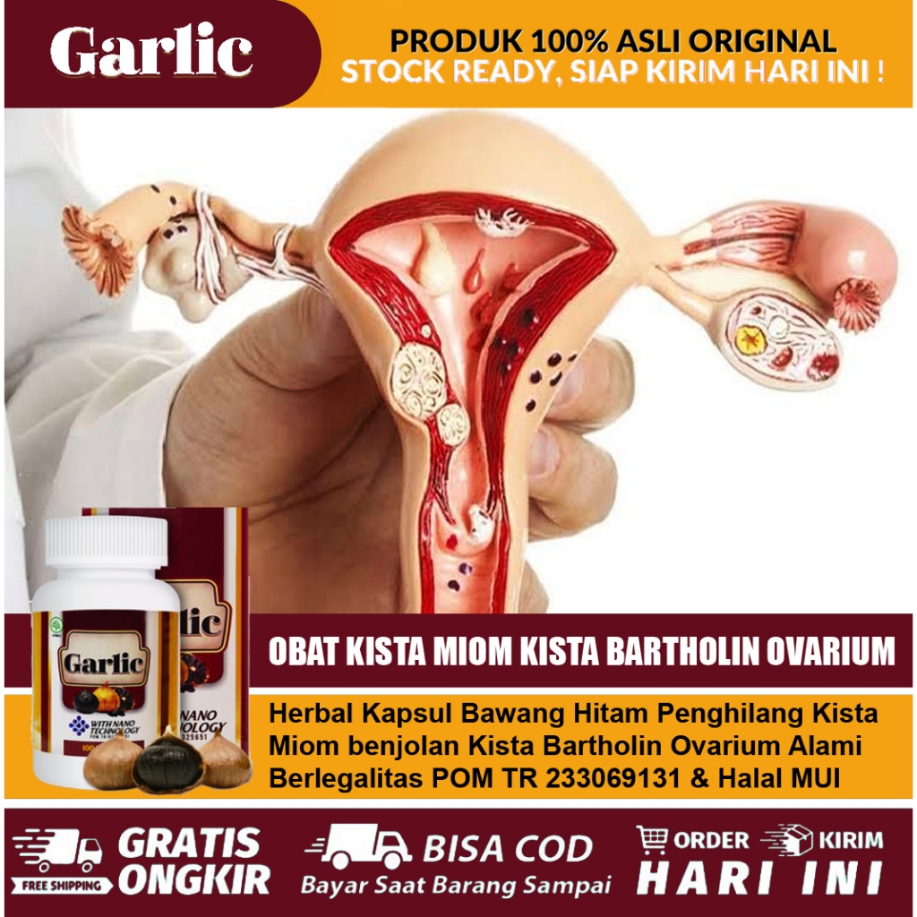 Obat Kista Miom di Vagina Kista Bartholin Ovarium Miom Endometriosis Kista Ganglion - Garlic