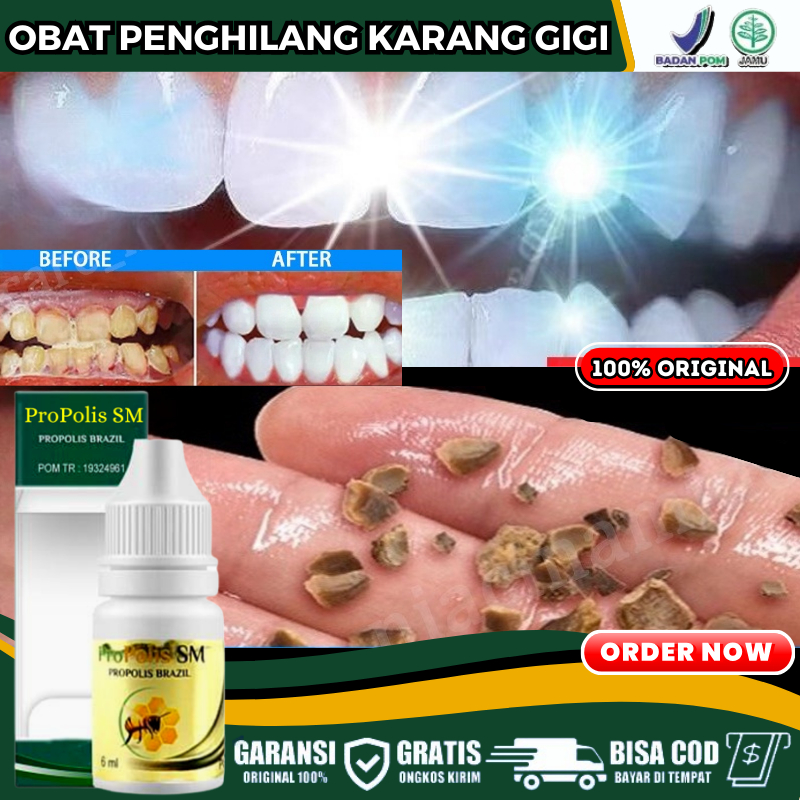 Obat Tetes Perontok Karang Gigi 100% Herbal, Penghilang Karang Gigi Membandel, Obat Oles Pembersih G