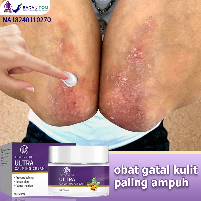 Obat gatal selangkangan Obat panu Salep gatal Obat kurap 30g Obat gatel Obat eksim Obat gatal gatal 