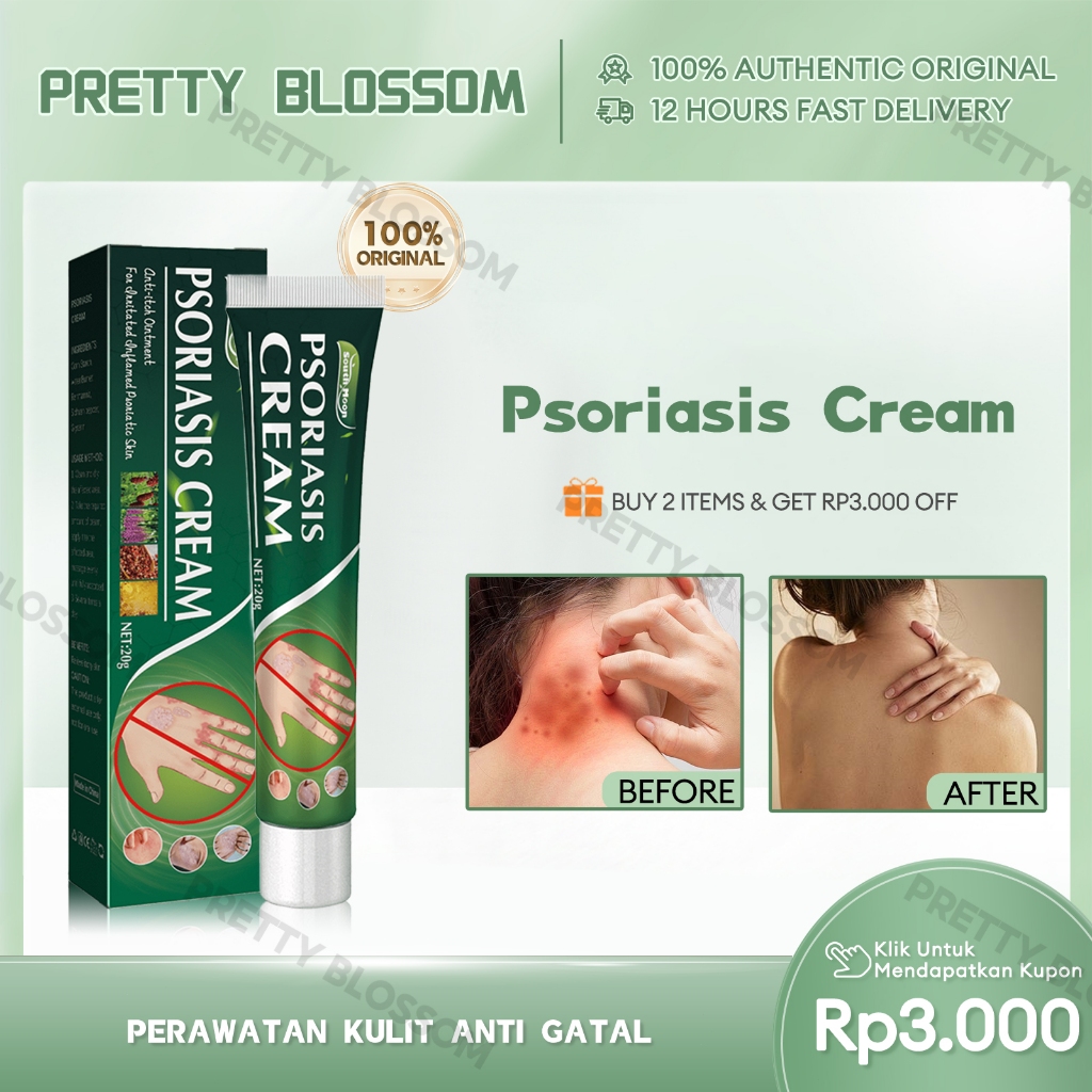 South Moon Psoriasis Cream 20g Salep Gatal Paling Ampuh Repair Skin Moss Psoriasis Cream Obat Psoria