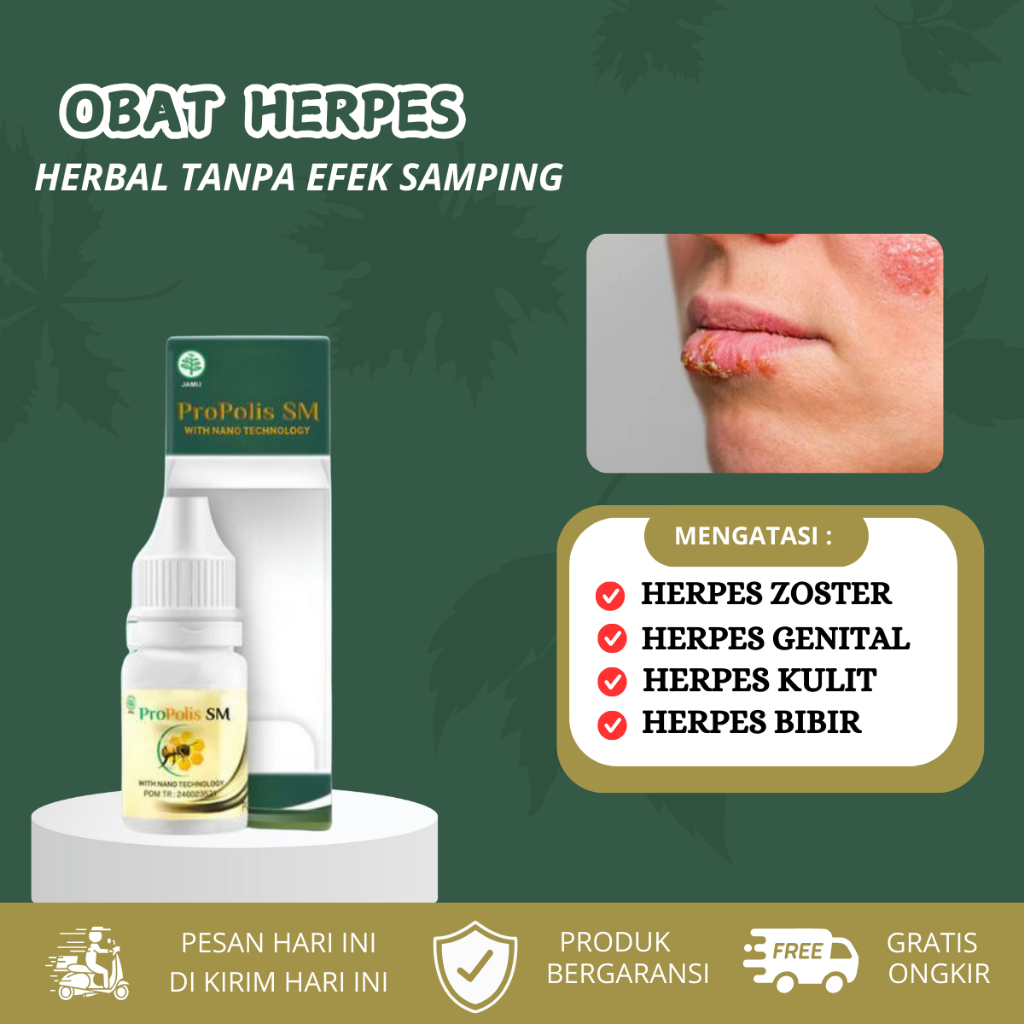 Obat Herpes Zoster, Herpes Genital, Herpes kulit, herpes bibir, Obat penghilang herpes
