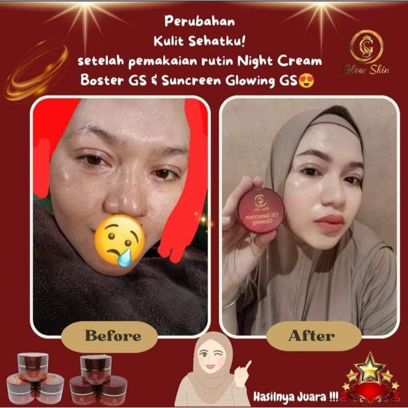 GLOWSKIN GS (sepasang Suncreen Glowing GS + Night Cream Boster GS)