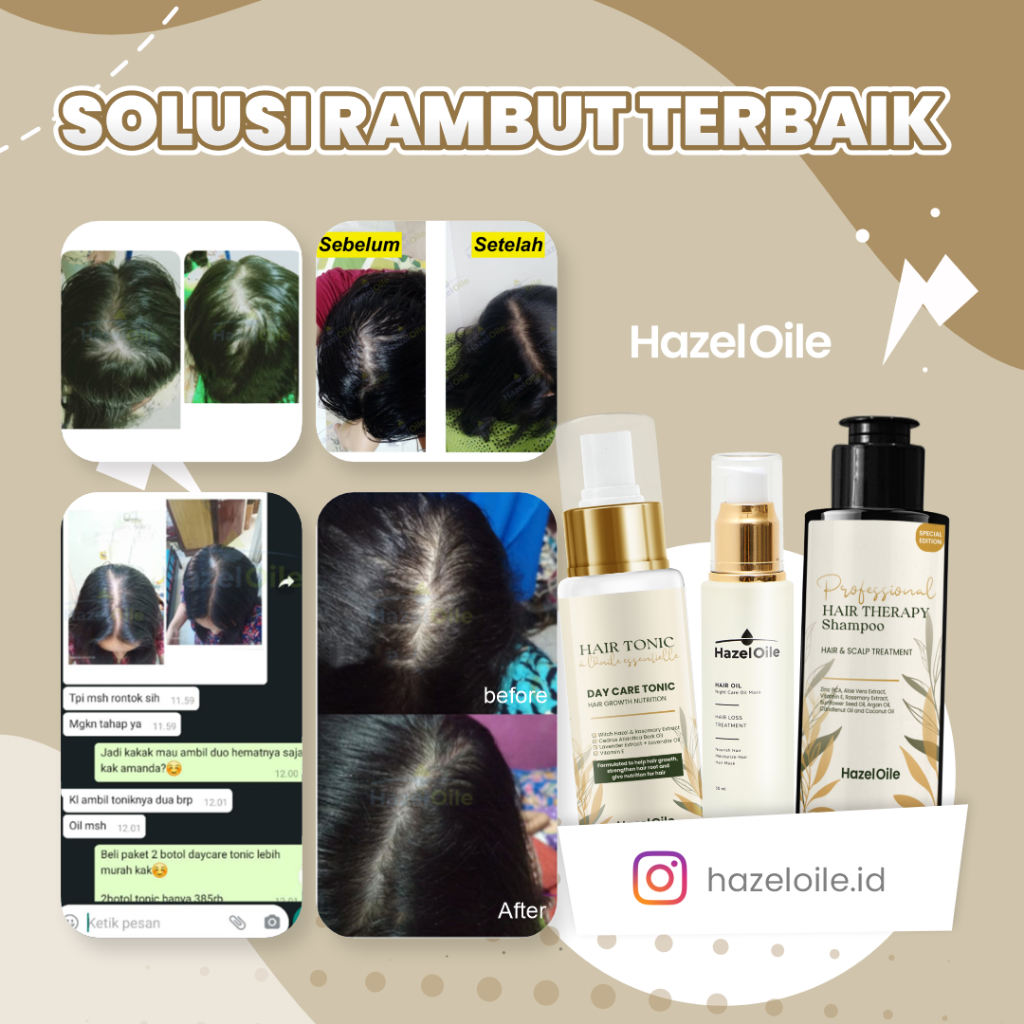 [BPOM] HazelOile Rambut Rontok Treatment Hair Tonic Tonik Penumbuh Botak Pitak Masker Shampoo Sampo